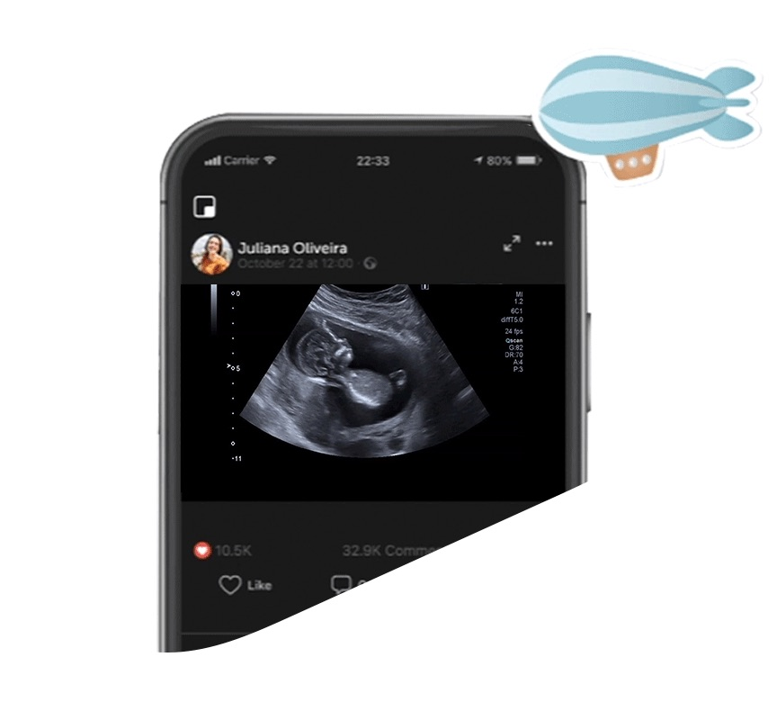 Use Seu Celular Como Um Ultrassom