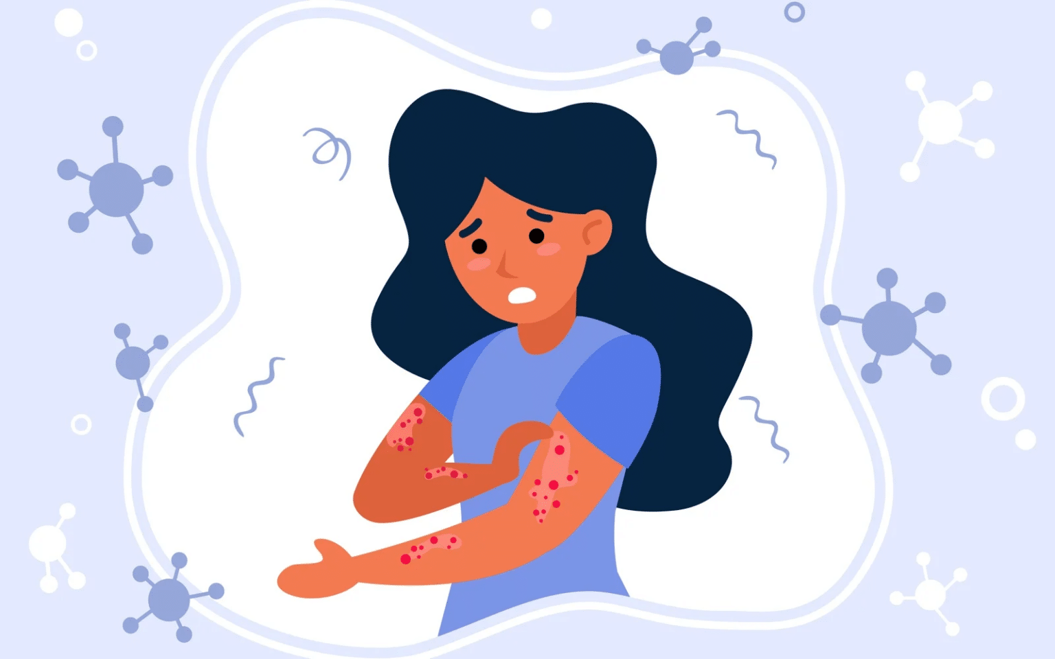 Rash Phase: The Most Visible Symptom